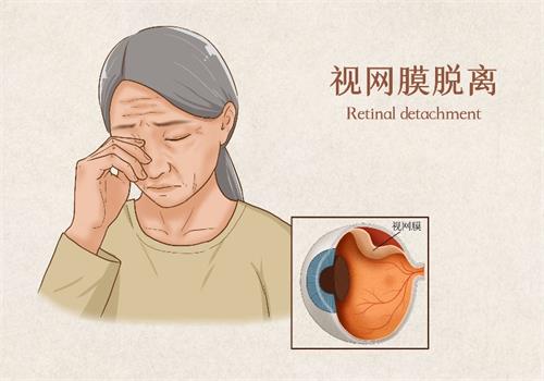 兰大二院眼科哪个医生看的好？张文芳、鲁建华、孙莉、任婉娜、律鹏等医生技术好口碑好！