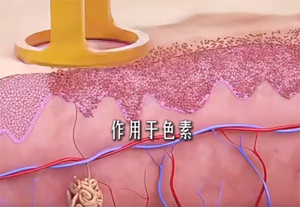 连云港眼科医院近视激光价位多少？半飞秒1万左右，全飞秒要1.5万起！