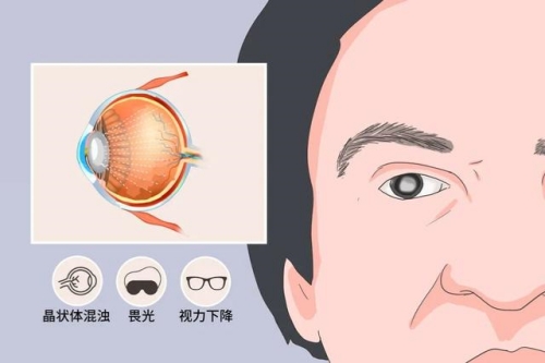 北京大学第三医院眼科医生名单：马志中、王常观、陈慧瑾、许艺民、冯学峰医生技术好口碑好！