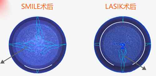 西安看眼科哪家又好又便宜？存济/医大/佰视佳/奕鸣眼科给出答案！