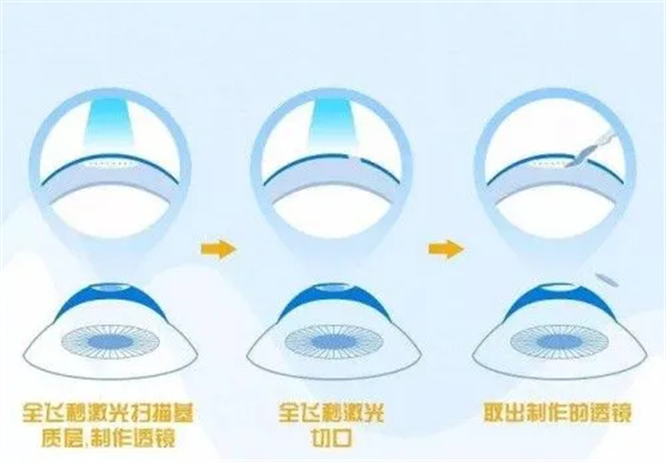 达州爱尔眼科医院怎么样？设备靠前医生专，看眼体验超满意