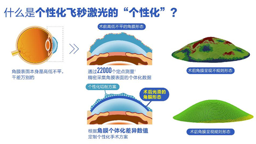 哈尔滨焦视眼科医院靠谱吗？资质正规诊疗规，市民看眼常选它