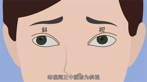 票选国内眼科斜视口碑好的医院排名：爱尔眼科/华厦眼科/普瑞眼科/希玛林顺潮眼科/朝聚眼科治疗斜视好！