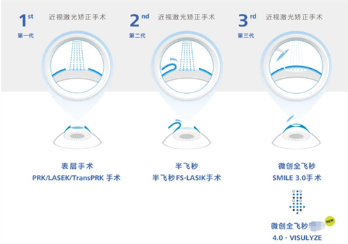 广州视可佳眼科价格表2025年:全飞秒/ICL/三焦点晶体_项目齐全!