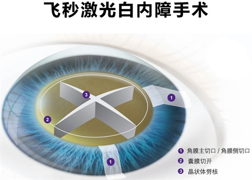 乌鲁木齐空军医院眼科电话号码多少?0991-5954120！支持电话预约挂号及询问医院医生信息！