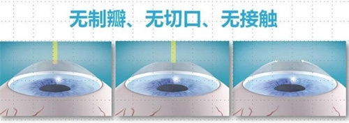 湖北眼科医院哪家好一点？武汉普瑞/爱尔/威沃眼科均实力在线，近视矫正、白内障诊疗各有优势，选对不踩雷