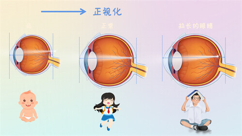 武汉同济医院眼科做近视眼手术要多少钱？从9000元到35000元起的25年新版价格表出炉，超详细！