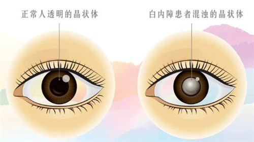 票选江门眼科医院排行榜：爱尔新希望眼科医院/光明眼科/五邑爱尔新希望眼科医院口碑好！