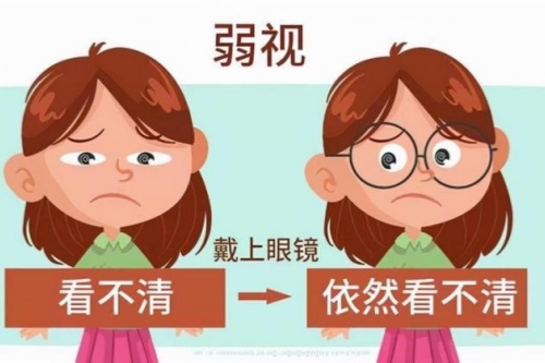 爱尔眼科医院斜弱视训练2025收费价目表更新：30元起单次基础训练/2000元起定制方案，梯度定价！