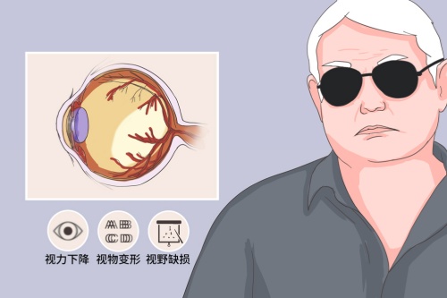 视神经萎缩有望被治好！2025视神经萎缩治疗取得突破性进展！