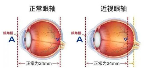 301眼科在国内能排第几？网评稳居前三！疑难眼病会诊平台、手术技术成熟、跨学科协作能力强
