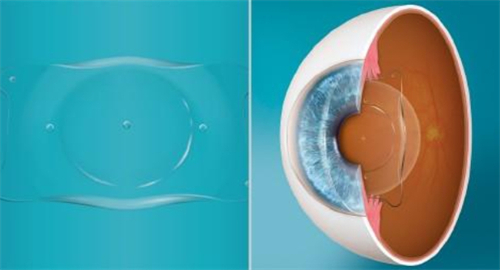 广州眼睛检查哪家医院好?推荐普瑞眼科/爱尔眼科:完善查眼底+验光精密,当天出报告不折腾!