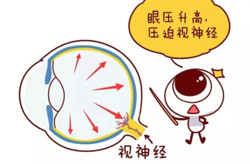 视神经病变的临床表现及常见原因！一文读懂早期信号，及时发现能挽救！