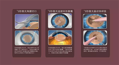 新疆一附院眼科白内障哪个医生好？这几位医生手法细腻值得信赖！在