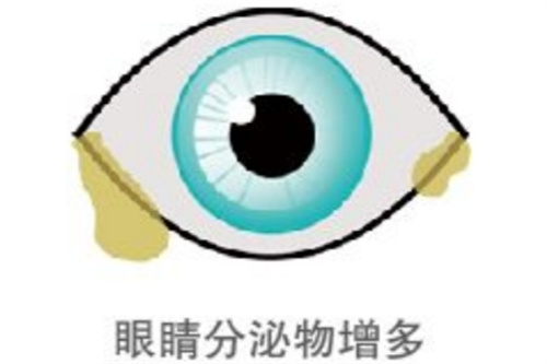 国内眼科医生排行榜2025年网友在线推荐版本:斜视/近视/青光眼/白内障医生均有简介!