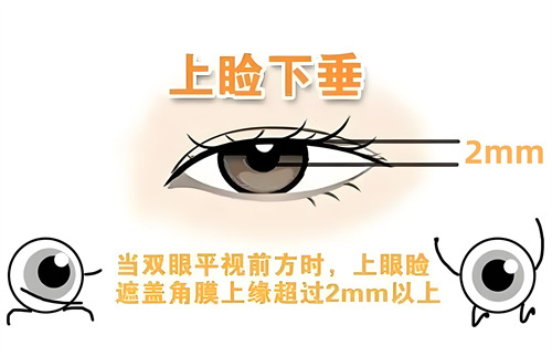 武汉爱尔眼科医院汉口医院王育红简介:擅长眼整形/上睑下垂矫正_手术近万例_口碑医师!