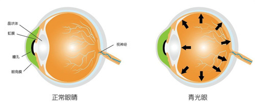 重医附一院做青光眼手术好吗？医生团队成熟，术后眼压控制稳定！