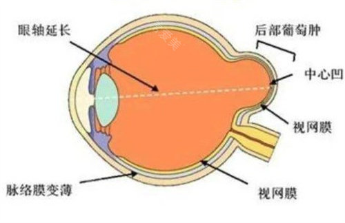 北京可约后巩膜加固术医生:提前一周能约的热门医生，这几位值得选！