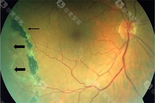 兰州新区第一人民医院眼科从哪里挂号预约？现场和线上两种方式都能预约！