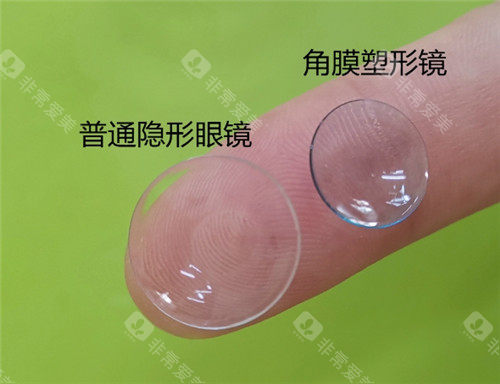 普通眼镜和角膜塑形镜对比照片