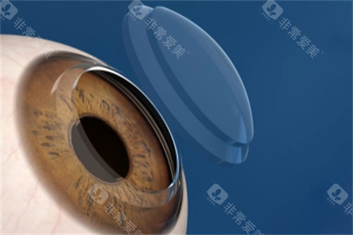 大连第三人民医院眼科医生哪位好?张立军/邹吉新/梁巍/林松/姜熔光医生技术好口碑好！