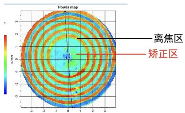 近视配镜前检查图解
