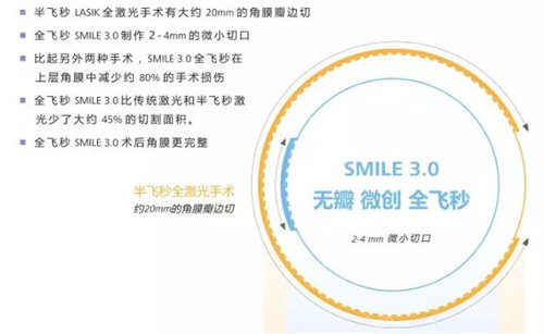 全飞秒手术3.0