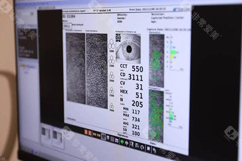 广州视百年眼科诊疗改善