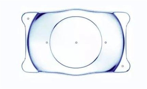 什么是ICL人工晶体