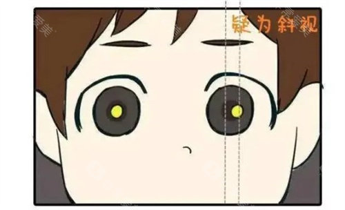 小朋友斜视素材图片