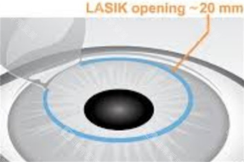 北京宜视康眼科超正规！资质可查+操作严谨，高端眼健康服务有支持