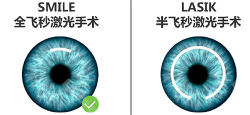 半飞秒和全飞秒手术区别图