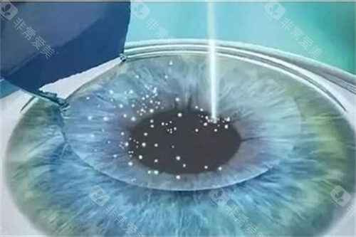 湖北恩施慧宜眼科预约挂号超简单！线上平台快速约，提前对接需求，不耽误看眼