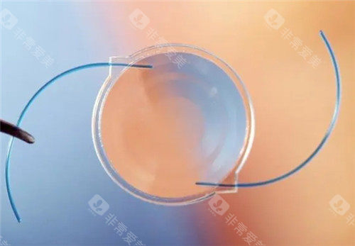 白内障晶体照片