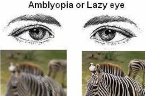 弱视视物对比图