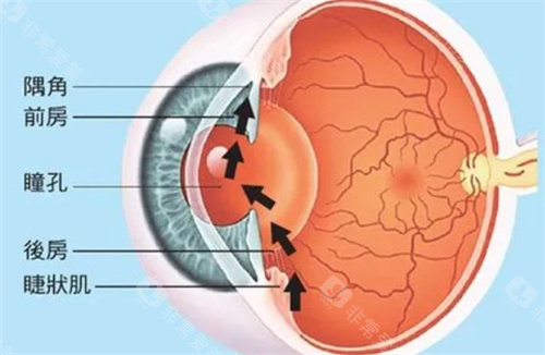 北京民众眼科做青光眼手术费用是多少钱？青光眼不同手术方式价格清单！