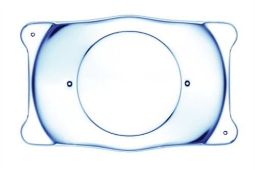 香港大学深圳医院眼科怎么样？多学科协作（MDT）诊疗，复杂眼病处理能力强！