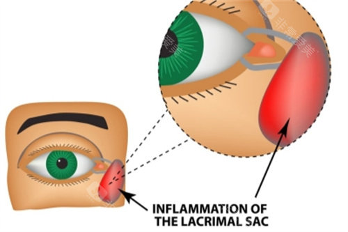 海南省人民医院眼科刘名皎医生怎么样？专攻泪器/眼眶疾病，出诊时间公布