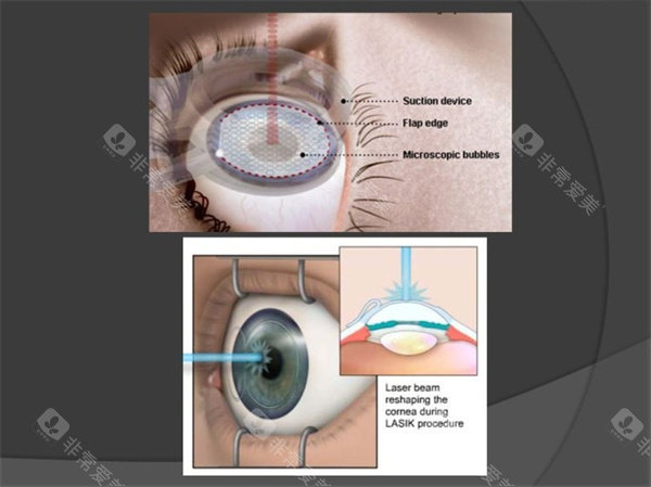重庆西南医院眼科怎么预约挂号？微信/官网/现场多方式，30天号源提前锁，电话地址一次备齐！