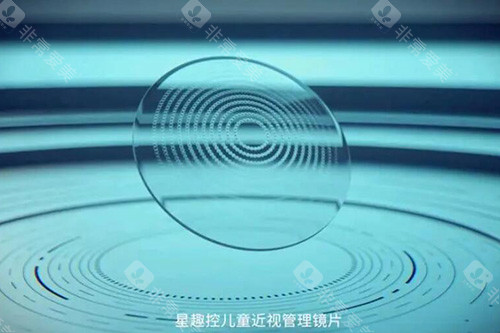 星趣控儿童近视管理镜片