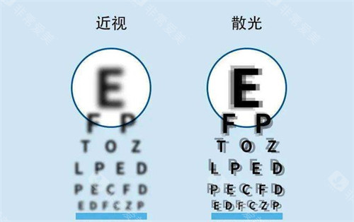 近视眼镜和散光的区别