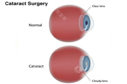上饶铁路眼科医院预约电话是多少？0793-8251523可在线预约挂号