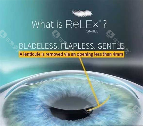 兰州眼科近视眼手术哪家医院好?爱尔眼科、普瑞眼科、华厦眼科做近视矫正手术口碑好！