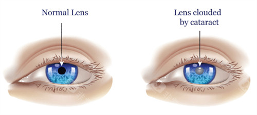 白水眼科医院电话号码_上班时间_简介介绍_收费价格表_地址路线_预约挂号方式! 