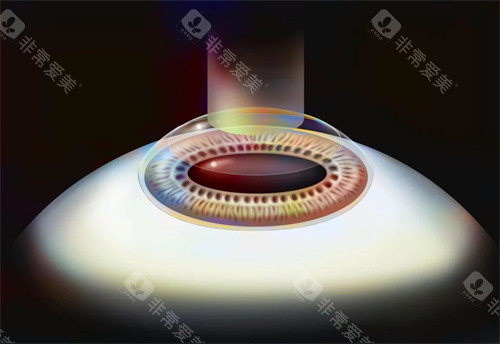 镇江华厦眼科怎么样？正规眼科专科|近视白内障手术强|地址在中山东路407号