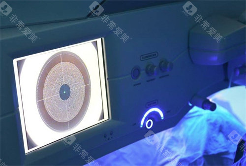 徐州威沃眼科怎么样？云龙区正规眼科|近视白内障手术强|医生团队经验足