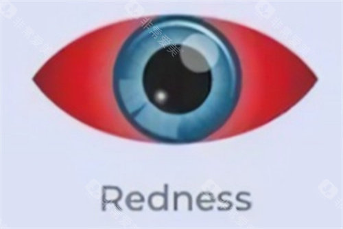 干眼症眼睛红肿