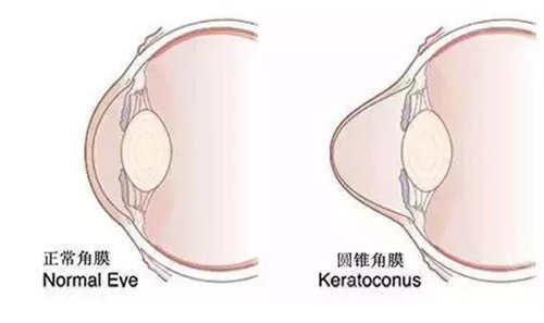 重庆南坪爱尔刘建娣医生怎么样?眼表角膜病诊疗_10余年经验_南岸区南城大道可约!