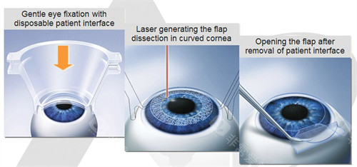 重庆南坪爱尔眼科医院怎么样?30余年经验医生团队_眼底病/白内障/屈光矫正全覆盖!