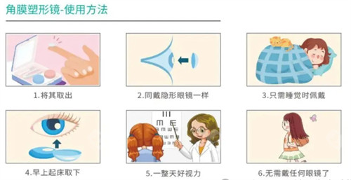 角膜塑形镜使用方法